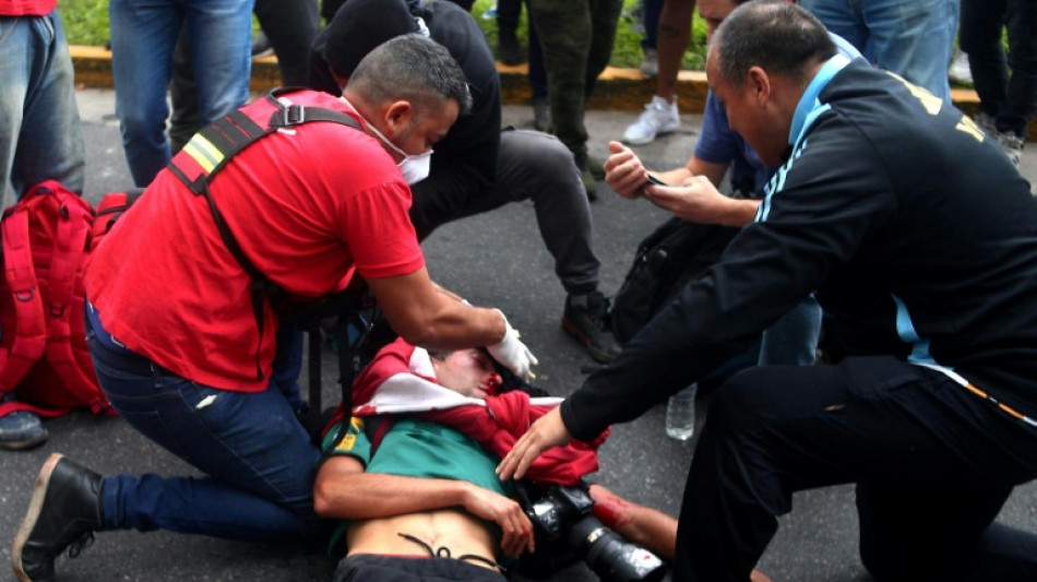 Argentine: un journaliste dans un état critique au lendemain d'une manifestation de retraités