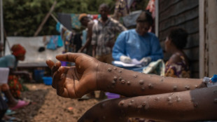 Mpox vaccines administered in Rwanda, first in Africa