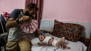 La sarna y los piojos se propagan entre los niños de Gaza